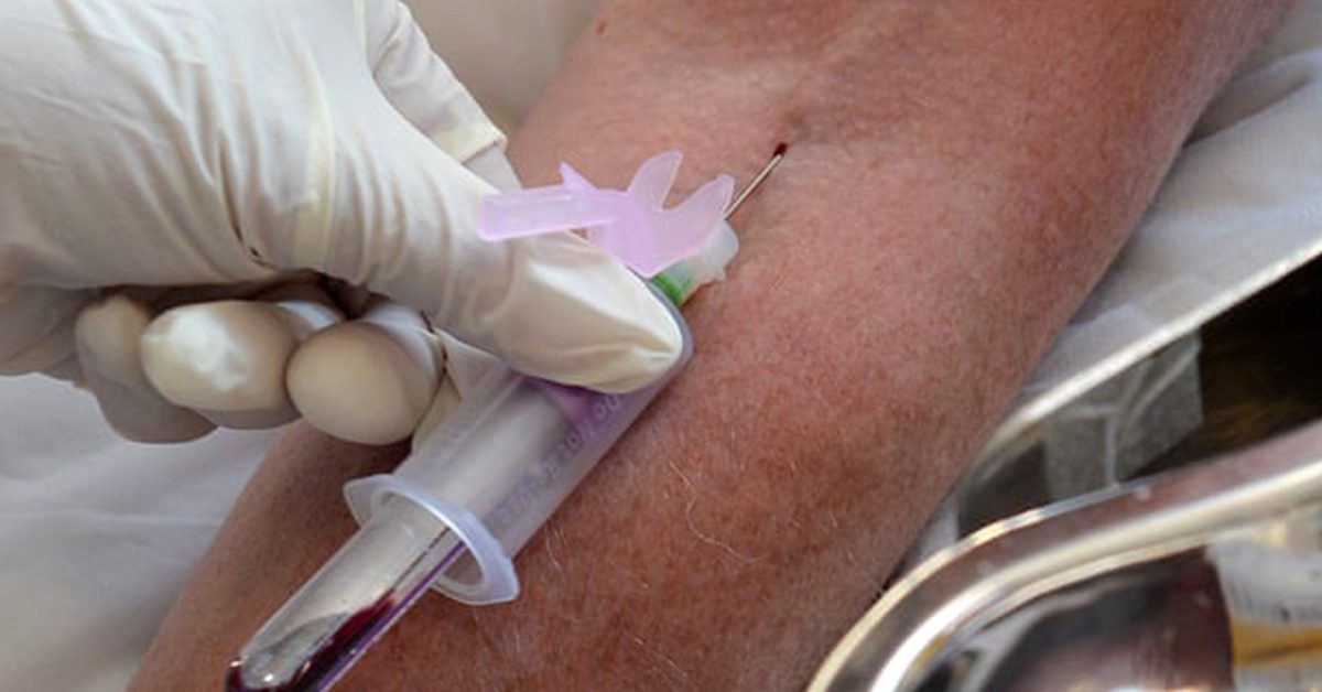 « Un test sanguin permet de détecter le cancer avant l’apparition des symptômes » affirment des scientifiques