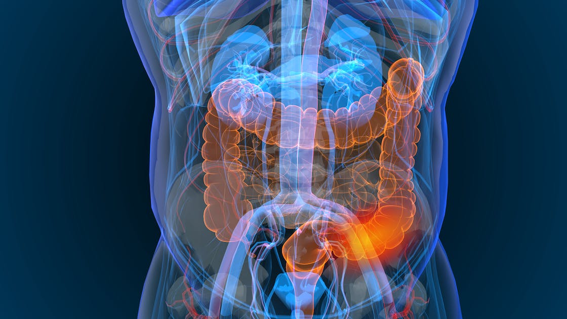 Cancer colorectal – Cancer du côlon et cancer du rectum : symptômes, traitements