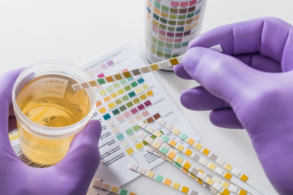 Un biomarqueur dans l’urine pourrait être le premier à révéler la maladie d’Alzheimer à un stade précoce