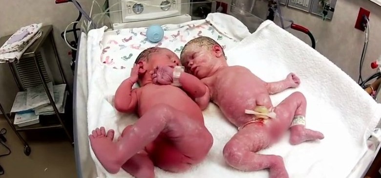 Ces jumeaux nouveau-nés ont pleuré jusqu’à ce que les médecins les mettent ensemble. Voici ce qui ce qui est arrivé. Incroyable! –