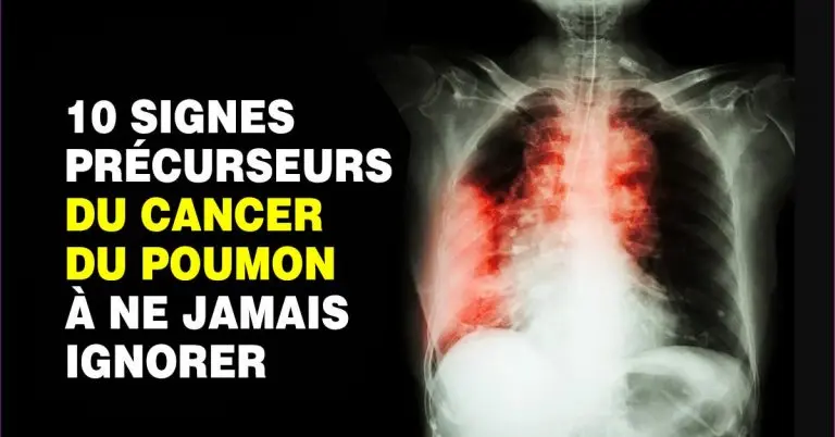 Les 10 signes précurseurs du cancer du poumon que tout le monde doit connaitre