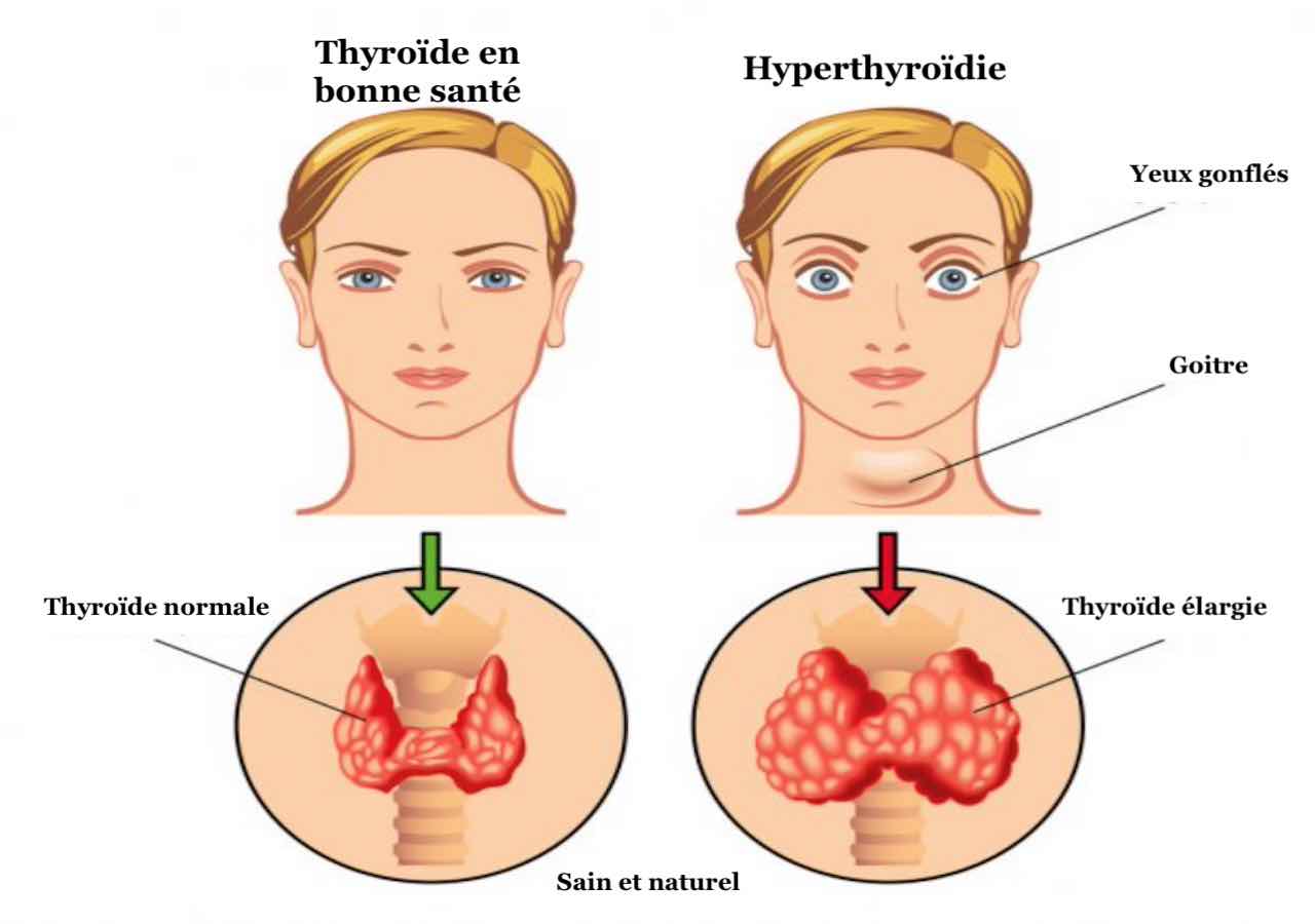 Ce test d’une minute vous indiquera si votre thyroïde fonctionne bien