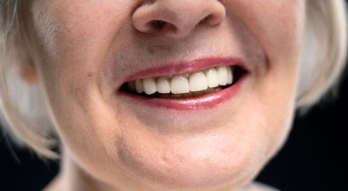 Un médicament innovant permettra aux dents adultes tombées de repousser une seconde fois