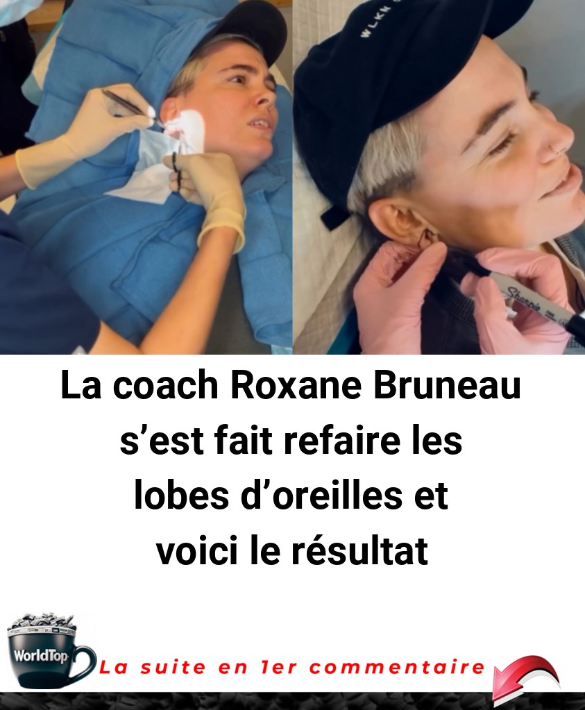 La coach Roxane Bruneau s'est fait refaire les lobes d'oreilles et voici le résultat