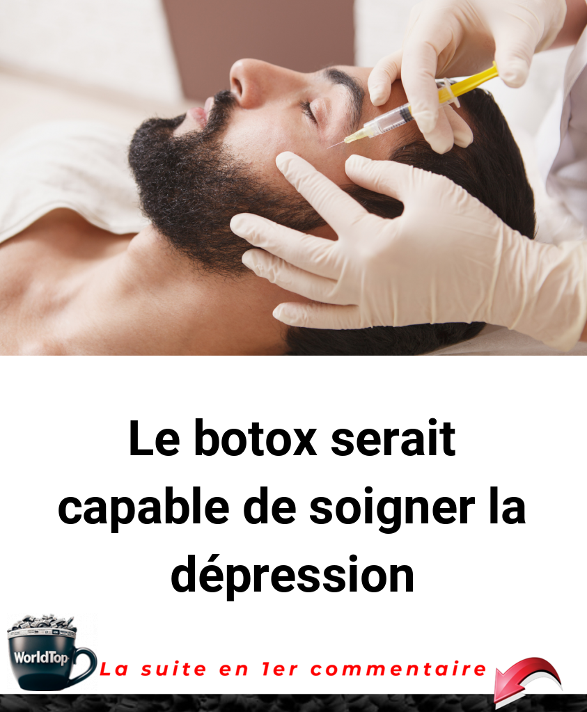 Le botox serait capable de soigner la dépression