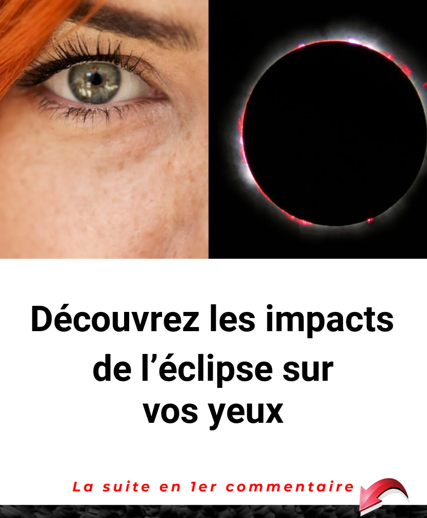 Découvrez les impacts de l'éclipse sur vos yeux