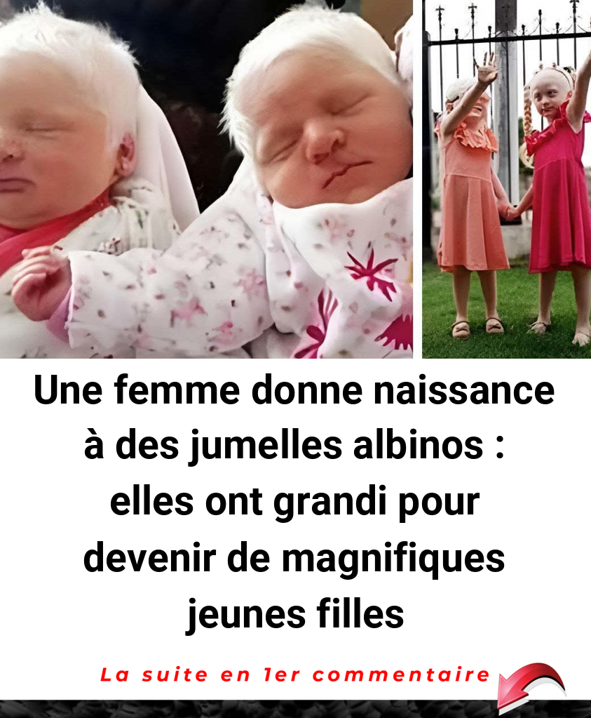 Une femme donne naissance à des jumelles albinos : elles ont grandi pour devenir de magnifiques jeunes filles